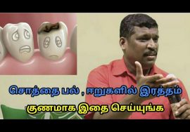 சொத்தை பல் குணமாக இதை செய்யுங்க | Treatment for Tooth decay by Healer baskar