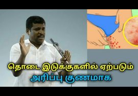 தொடை இடுக்குகளில் ஏற்படும் அரிப்பு குணமாக | Healer baskar speech on thigh itching treatment