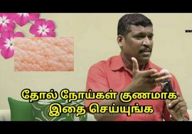 தோல் நோய்கள் குணமாக இதை செய்யுங்க | Skin disease treatment by Healer Baskar