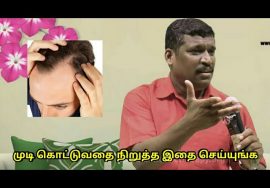 முடி கொட்டுவதை தடுக்க இவர் சொல்வதை கேளுங்க | Hairfall treatment by Healer Baskar Sir