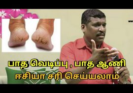 பாத வெடிப்பு மற்றும் ஆணியை ஈசியா சரி செய்யலாம் | Healer baskar speech on foot cracks and toe nail
