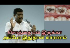 சொத்தை பல் குணமாக இதை செய்யுங்க | Healer baskar speech on Tooth decay treatment